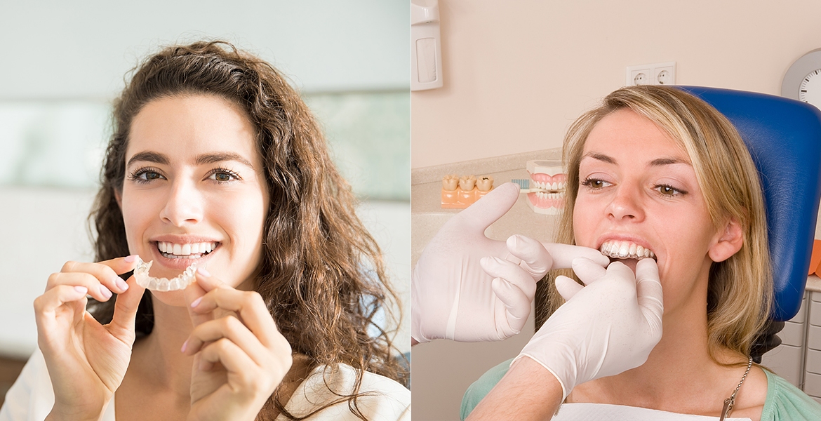 invisalign braces nyc invisalign braces nyc